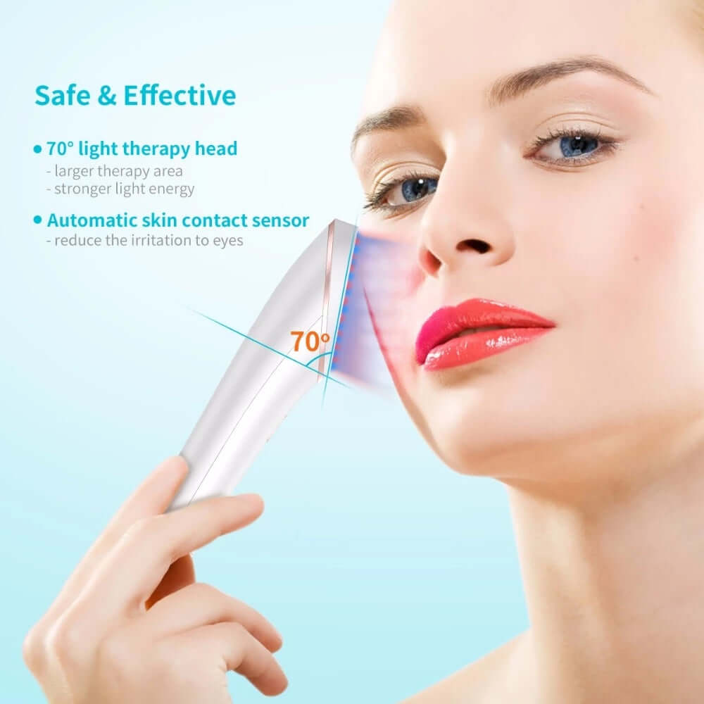 Wireless Acne Light Therapy Device